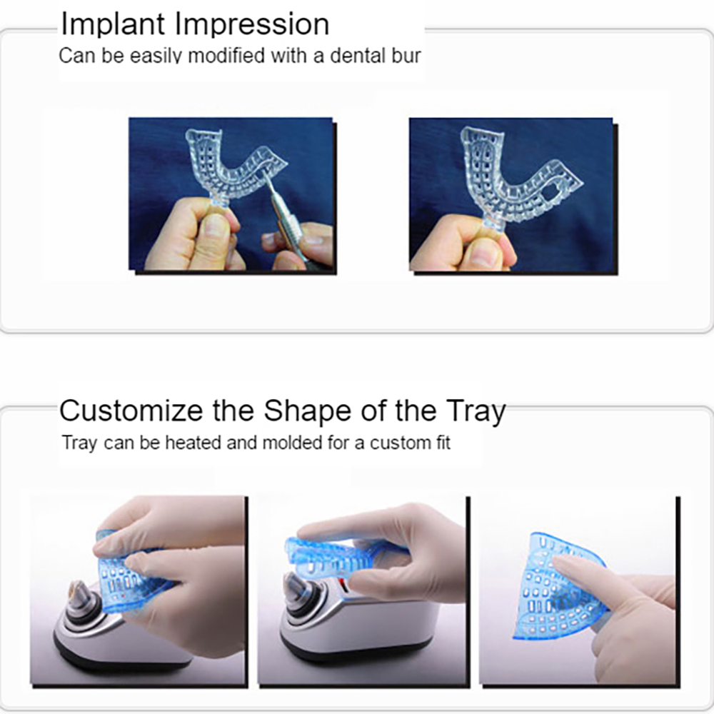 Impression Trays, Perforated, Assorted